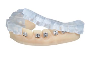 https://asset.dynamism.com/media/catalog/products/envisiontec-envision-one-dental_img14.jpg